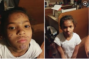 AMERICA IS DYING: Bullies wrote ‘loser’ on 10-year-old girl’s forehead…