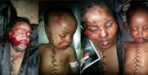 Egypt: Cracking down on trafficked human organs…