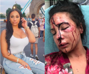NFL VIOLENCE OUT OF CONTROL: Buffalo Bills RB Accused Of Domestic Violence In Graphic Instagram Post…