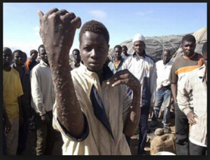 Walter Williams: “What’s coming over into the U.S. could harm everyone. We are starting to see scabies, chickenpox, methicillin-resistant Staphylococcus aureus infections and different viruses.”…